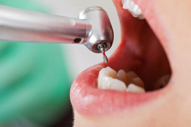 Best Emergency TMJ Treatment in Chamblee, GA